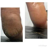 پاکسازی صورت/موژه/پدیکورپا(اموزش هم داده‌میشود)|خدمات آرایشگری و زیبایی|اهواز, شهرک دانشگاه|دیوار
