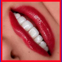 عصبکشی/کامپوزیت/ترمیم/روکش/جرمگیری پالیش بریج