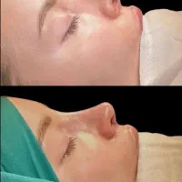 جراحی زیبایی بینی در پایتخت جراحی بینی ایران|خدمات آرایشگری و زیبایی|مشهد, عنصری|دیوار