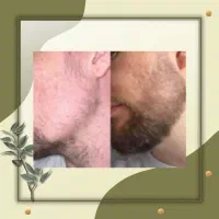 بدونه نیاز به کاشت فقط اقدام کنید