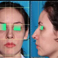 عکاسی تخصصی پزشکی ،مشاوره جراحی زیبایی و درمانی