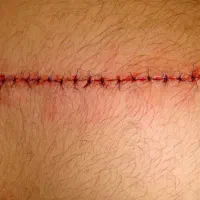 تزریقات و سرم تراپی و سونداژ در منزل توسط خانم|خدمات آرایشگری و زیبایی|تبریز, |دیوار