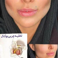 تزریق چربی فیلر کانتورینگ بوتاکس نخ لیفت مزوتراپی|خدمات آرایشگری و زیبایی|اصفهان, بوستان آینه خانه|دیوار