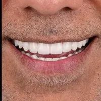 انجام خدمات دندان پزشکی|خدمات آرایشگری و زیبایی|کرج, شهریار|دیوار