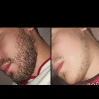 ریشو|آرایشی، بهداشتی، درمانی|گزنک, |دیوار