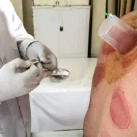 حجامت سنتی مراعات بهداشتی|خدمات آرایشگری و زیبایی|خاش, |دیوار