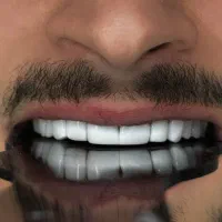 جشنواره کامپوزیت لمینیت روکش عصب ترمیم IMAX IPS|خدمات آرایشگری و زیبایی|تهران, هفت حوض|دیوار