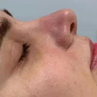 پاکسازی ۲۹۰، فیشیال ،جوانسازی صورت پوست کره ای|خدمات آرایشگری و زیبایی|علیآباد کتول, |دیوار