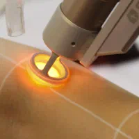 اپراتور دستگاه لیزر شاتی