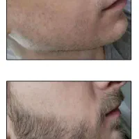 مرد به ریششه درخت به ریشش