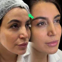 کلینیک پوست و مو و لیزر و زیبایی در اسلامشهر|خدمات آرایشگری و زیبایی|اسلام‌شهر, باغ فیض|دیوار