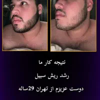 مشاوره تخصصی پوست و مو|آرایشی، بهداشتی، درمانی|تهران, دهم فروردین|دیوار
