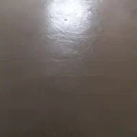 فوم بتن رسولی