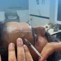 جشنواره بوتاکس|خدمات آرایشگری و زیبایی|اردبیل, |دیوار