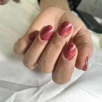 کاشت و ترمیم ناخن