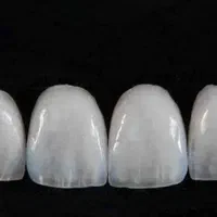 خدمات کلینیک دندانپزشکی