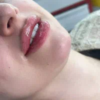 کلینیک بوتاکس وفیلر و هایفو و فیلر بادی و ریموتتو|خدمات زیبایی و سلامت|کرج, عظیمیه|دیوار