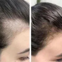 تخفیفات ویژه و تکرار نشدنی فیشال و....