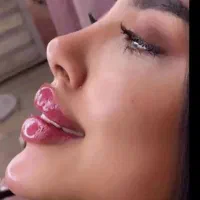 مدل جهت ژل وبوتاکس وانزیم|خدمات آرایشگری و زیبایی|نهاوند, |دیوار