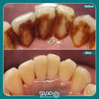 جرم گیری رایگان|خدمات آرایشگری و زیبایی|بیرجند, |دیوار