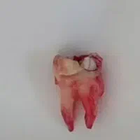 دندان سالم و آماده برای دانشجویان دندان پزشکی