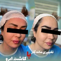 کاشت ابرو فقط با۶ میلیون|خدمات آرایشگری و زیبایی|رشت, گلسار|دیوار