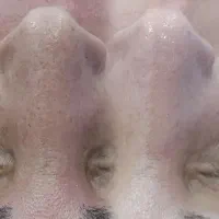 نیازمند فوری مدل فشیال