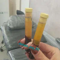 جوانسازی ، تقویت مو ، پی ار پی ، کاشت