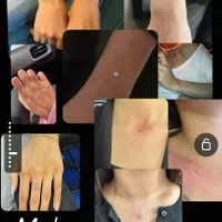 پرسینگ و میکرودرمال تخصصی آموزش (کلینیک ،مسکن)|خدمات آرایشگری و زیبایی|کرمانشاه, |دیوار