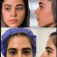 وام جراحی و انجام خدمات زیبایی