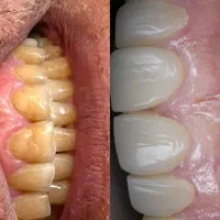 دندانپزشکی دکتر بازویار