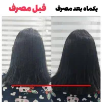 تونیک ضدریزش و رویش مجدد هیرفرند|آرایشی، بهداشتی، درمانی|تهران, نیروی هوایی (پیروزی)|دیوار