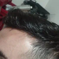 ترمیم مو نوین