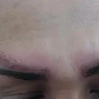 پاک کردن تتو ابرو ریمو تک جلسه ای تضمینی +آموزش|خدمات آرایشگری و زیبایی|خرم‌آباد, |دیوار