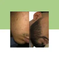 بلندش کن|آرایشی، بهداشتی، درمانی|فاریاب, |دیوار