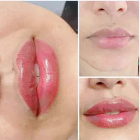 زیبایی.پی ارپی جوانسازی و ژل و بوتاکس.|خدمات آرایشگری و زیبایی|اصفهان, شهرک کاوه|دیوار
