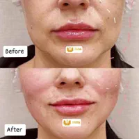 تزریق ژل و بوتاکس|خدمات آرایشگری و زیبایی|اهواز, نادری|دیوار