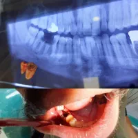 کلیه خدمات دندانپزشکی . زیبایی|خدمات آرایشگری و زیبایی|رشت, گلسار|دیوار