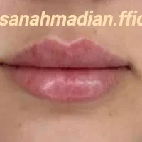 آموزش وخدمات ژلوبوتاکس.پرسینگ.حجامت.زالو.پرستاری|خدمات آرایشگری و زیبایی|پرند, فاز ۲|دیوار