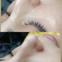 جشنواره تخفیفی فیشال تخصصی صورت|خدمات آرایشگری و زیبایی|مشهد, هفده شهریور|دیوار