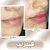 تخفیفات روز پدر کلینیک زیبایی یاس