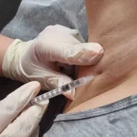 تزریق فیلر بوتاکس فیشال درمان لک جوش چین و چروک|خدمات آرایشگری و زیبایی|محمدشهر, محمدشهر|دیوار