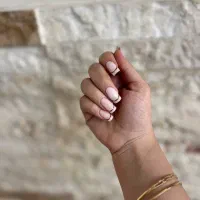 کاشت و ترمیم ناخن