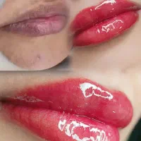 فیبروز ابرو-شیدینگ