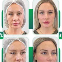 هایفو تراپی/پلاژن تراپی/کربوکسی/لیزربدن|خدمات آرایشگری و زیبایی|مشهد, محمدآباد|دیوار