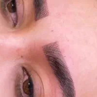 فیبروزومیکروبلیدینگ فقط یک ملیون تومان