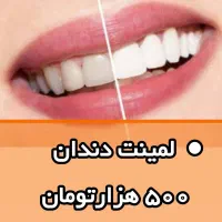 رایموندLM