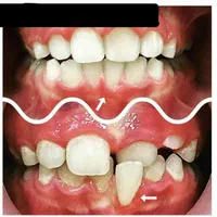 ارتودنسی کن ۶ الی ۱۸ماهه پرداخت کن
