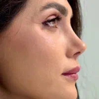 عمل جراحی زیبایی بینی،اندام،پلک|خدمات زیبایی و سلامت|تهران, افسریه شمالی|دیوار