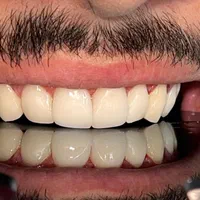 دندانپزشکی درمانی ایمپلنت زیبایی  با بهترین قیمت|خدمات آرایشگری و زیبایی|تهران, فلسطین (میدان انقلاب)|دیوار